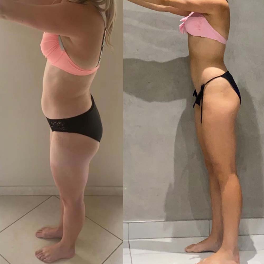 A client of Justine Holmes, before and after, 5 of 6